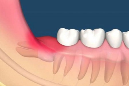 糖尿病早期信号竟然有15种!别再傻傻不知道
